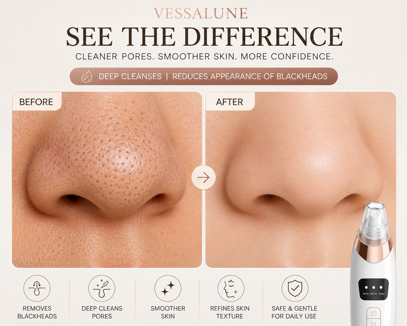 Vessalune ClearVeil Pro™ Pore Vacuum